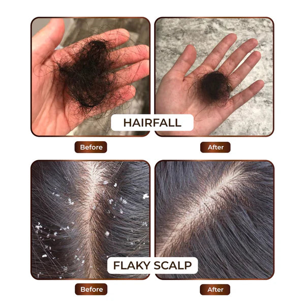 Hair Oil & Shampoo Combo Offer - Atman99