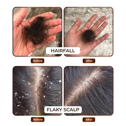 Hair Oil & Shampoo Combo Offer - Atman99