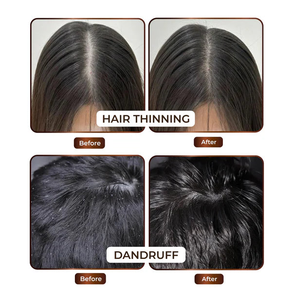 Hair Oil & Shampoo Combo Offer - Atman99